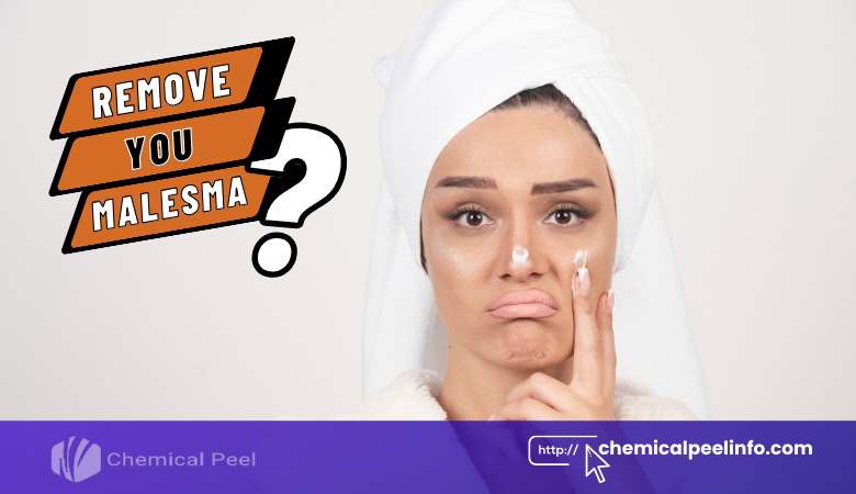 Does Chemical Peel Remove Melasma