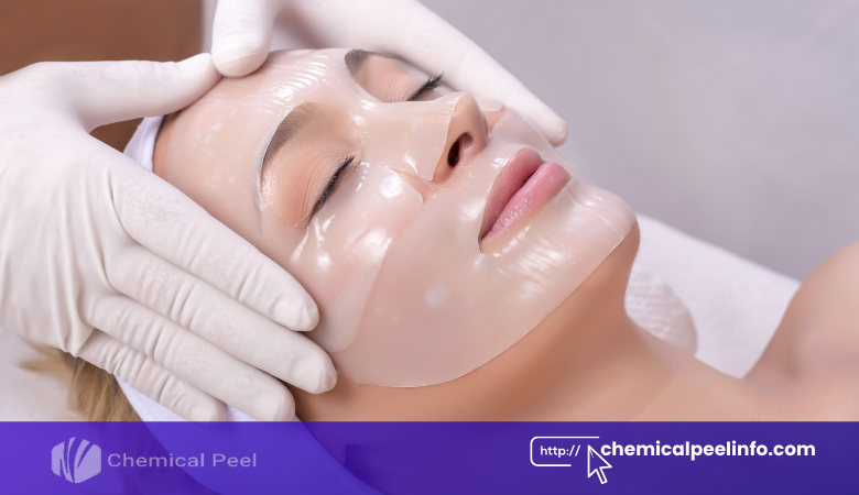 Detailed How Often To Get Chemical Peel Photo for Mobile Detailed How Often To Get Chemical Peel Photo for Mobile