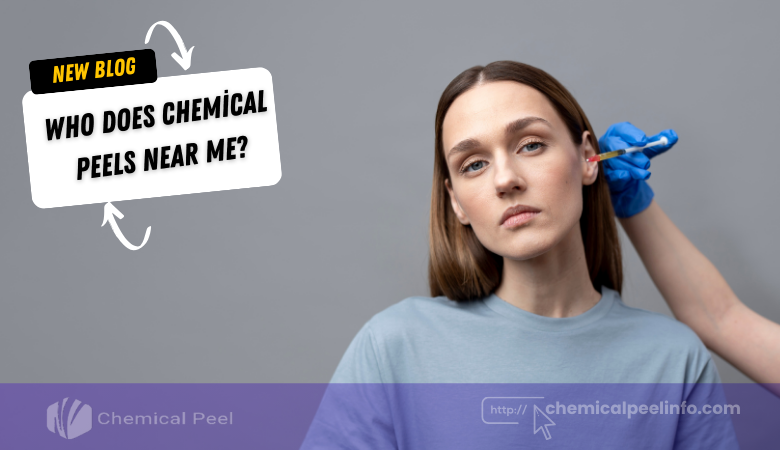 Who Does Chemical Peels Near Me