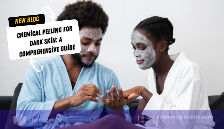 Chemical Peeling for Dark Skin A Comprehensive Guide