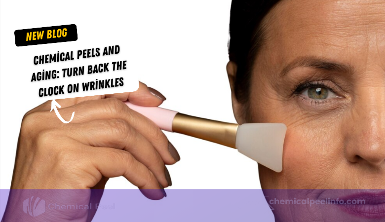 Chemical Peels and Aging Turn Back the Clock on Wrinkles