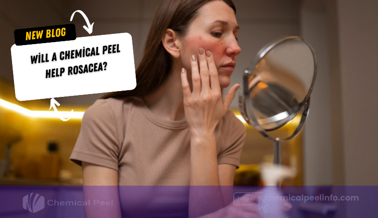 Will a Chemical Peel Help Rosacea (Ultimate Guide with Pros, Cons & Safety Tips)